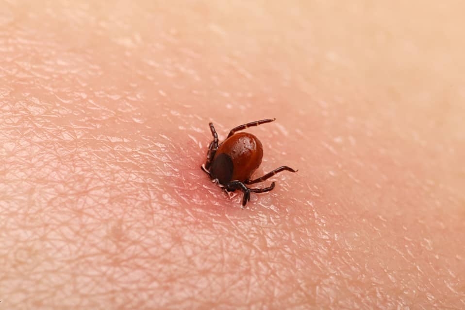 Tick burrowing into human skin. 