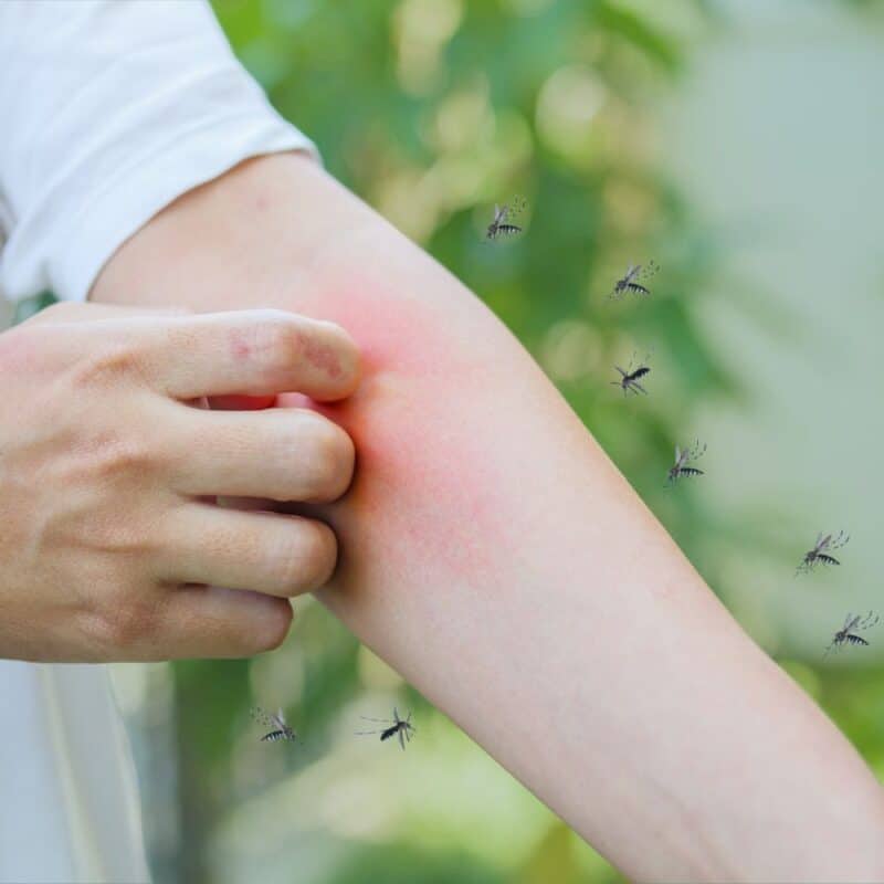 mosquito season prep